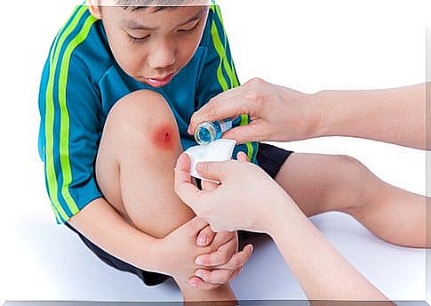 15 basic tips to take care of your children's wounds