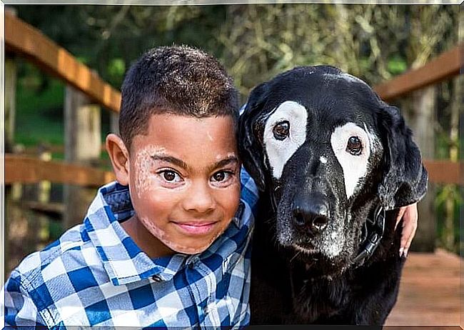 This child overcomes depression by meeting a dog with the same illness