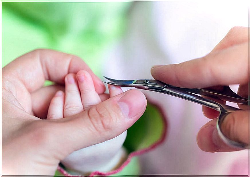 Ingrown toenails in babies