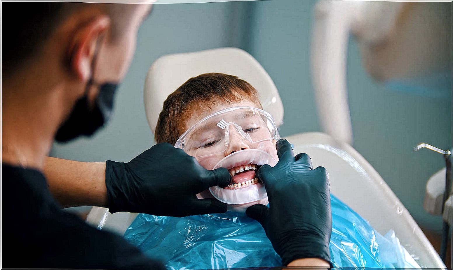 Sealing teeth in children