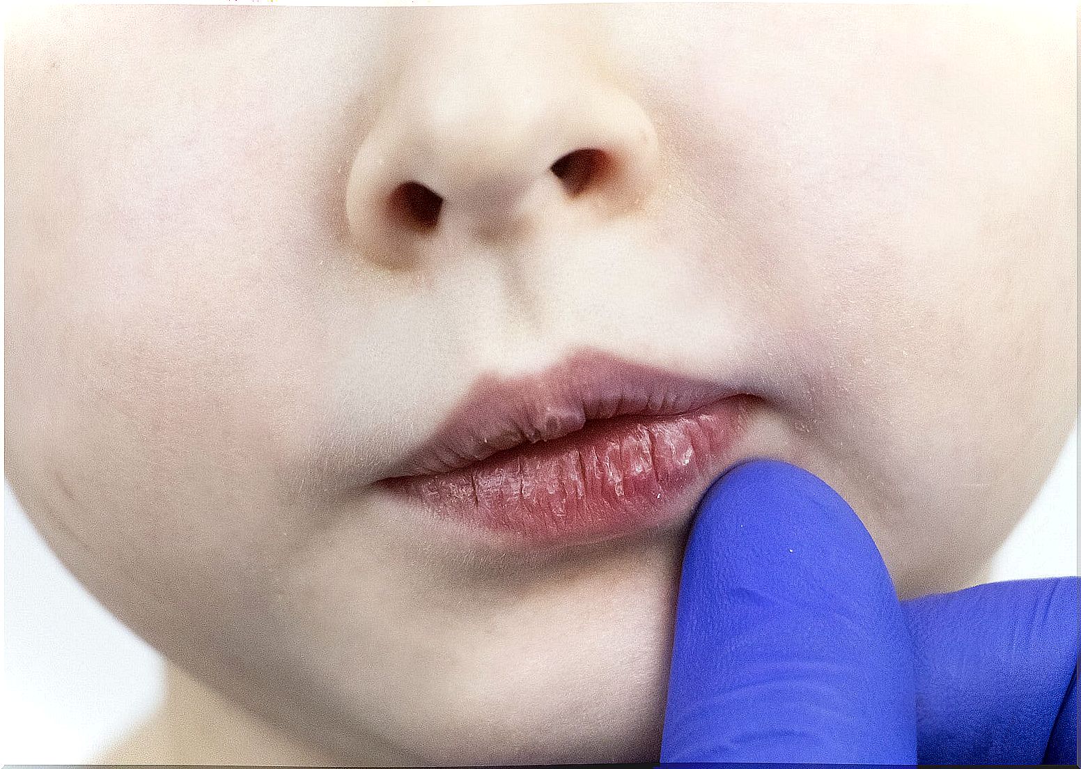 Why do children's lips get dry?