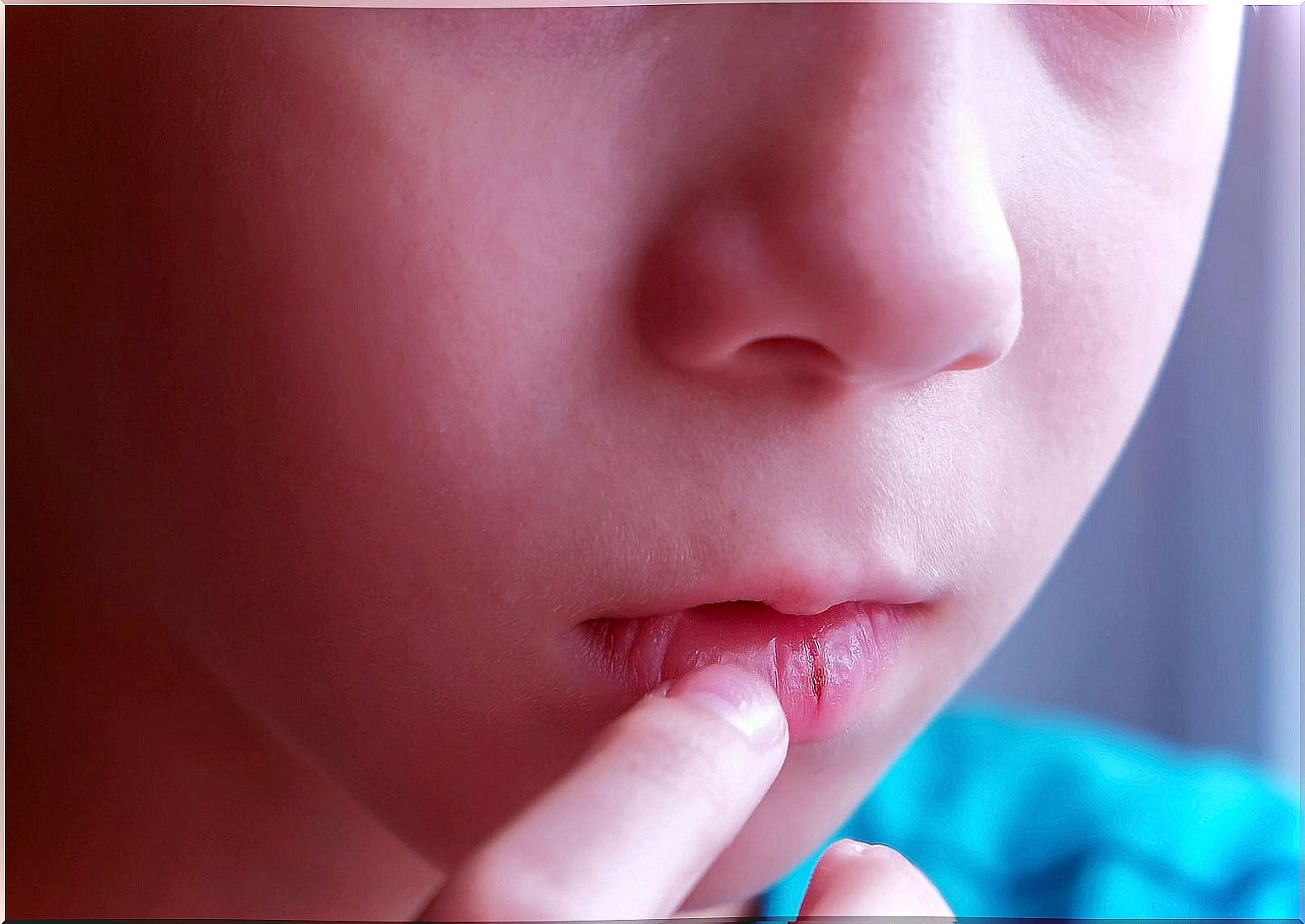 Child with chapped and dry lips.