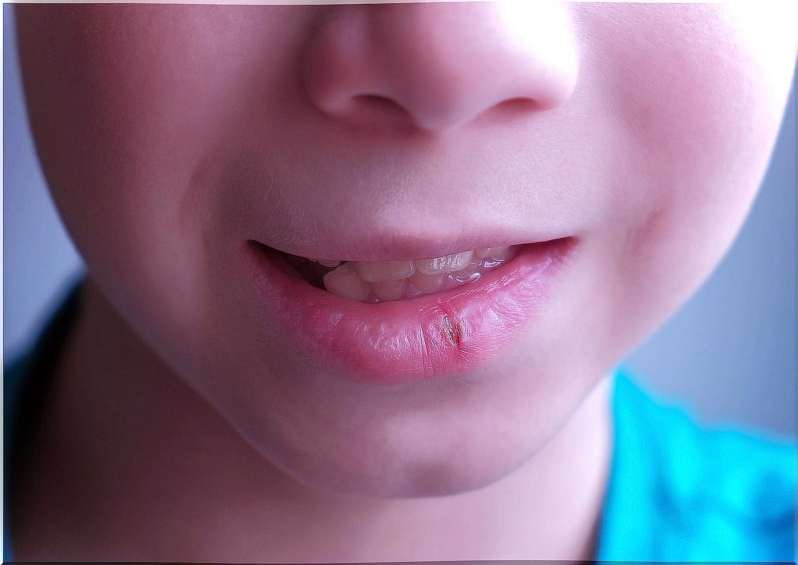 Chapped lips in children: causes and recommendations